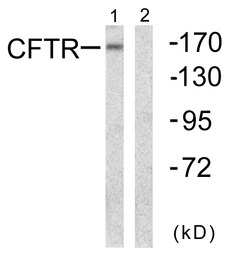 CFTR antibody