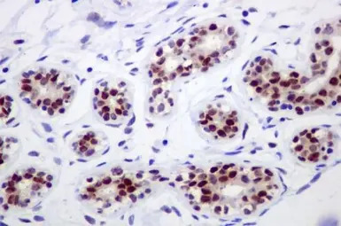 IKK alpha antibody [EPR464]