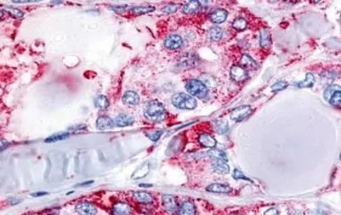 Calcitonin Receptor antibody