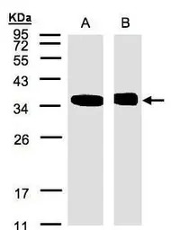 N-myc interactor antibody [N1C