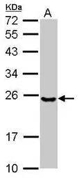 UBE2T antibody [C2C3], C-term