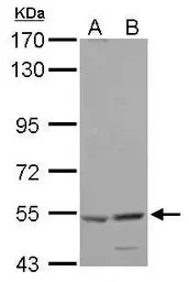 HARS antibody [N1C1]