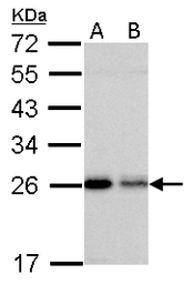 RAB5A antibody