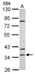 ZP1 antibody [C1C3]