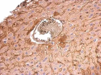 COL6A1 antibody [C1C2], Intern