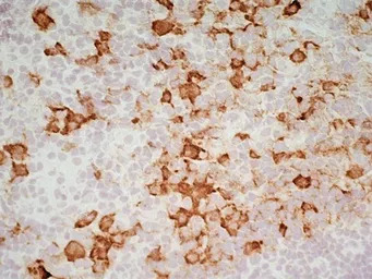 CD163 antibody [ED2]