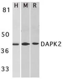 DAP Kinase 2 antibody