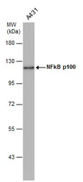 NFkB p100 antibody [C2C3], C-t