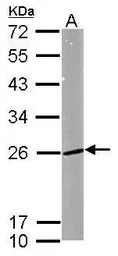 RAB5A antibody