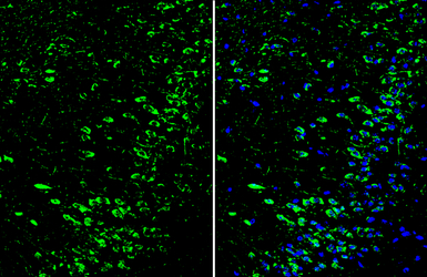 Dopamine Receptor D1 antibody 