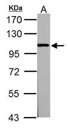 alpha Actinin 3 antibody