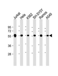 Calreticulin antibody, Interna