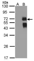 ST6GAL1 antibody [N2C3]