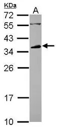 CD32B antibody [N2C3]