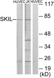 SnoN antibody