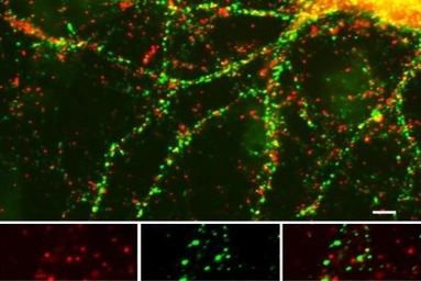 Munc18 (phospho Ser513) antibo