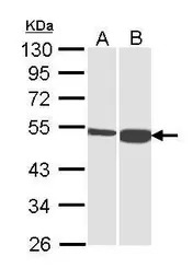 DBT antibody