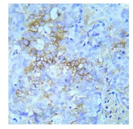 IGF1R (phospho Tyr950) antibod