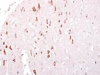 GTPBP3 antibody [C1C3]