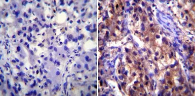 Sodium Potassium ATPase antibo