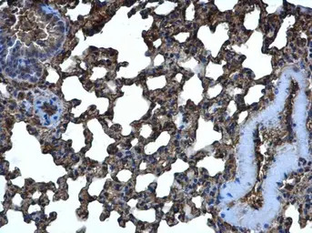 CRMP5 antibody [N1C1]