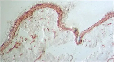 Collagen III antibody [FH-7A]