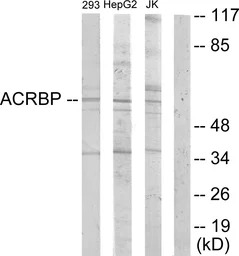 ACRBP antibody