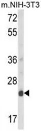 Derlin 1 antibody, C-term