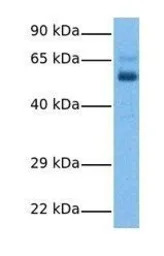 CPEB2 antibody, Internal