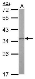 Tropomyosin 1 antibody