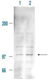 MDM2 (phospho Ser185) antibody