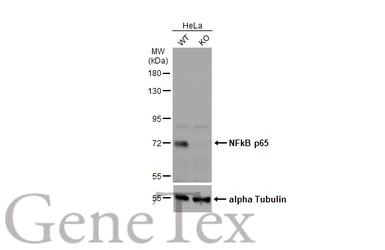 NFkB p65 antibody