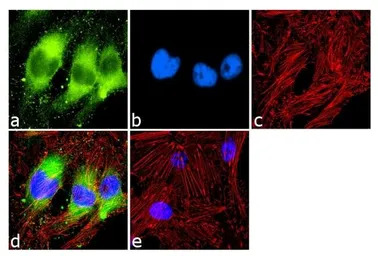 PPAR alpha antibody [3B6/PPAR]