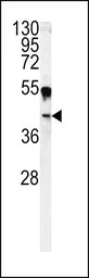 Carbonic Anhydrase 14 antibody