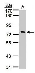 TTC30A antibody [C1C3]