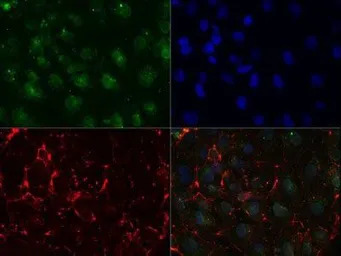 SSEA-1 / CD15 antibody [MC-480