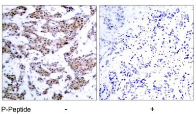 MEF2A (phospho Thr312) antibod