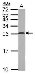 TPPP antibody [N1C3]