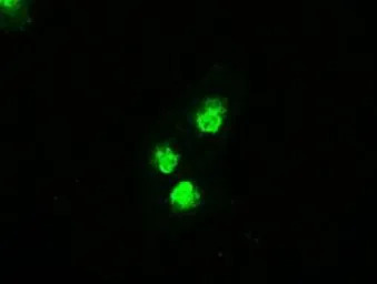 SEK1 / MKK4 antibody [8A8]