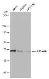 L-Plastin antibody