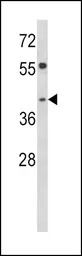 TOB2 antibody, N-term
