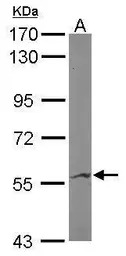 IMPDH2 antibody [N2C1], Intern