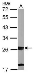 SBDS antibody [N1C3]