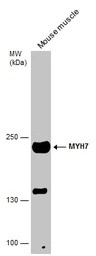 MYH7 antibody [N1], N-term