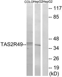 TAS2R49 antibody