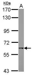 AChR beta 1 antibody [C1C3]