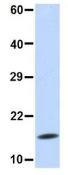 UBE2D3 antibody, N-term
