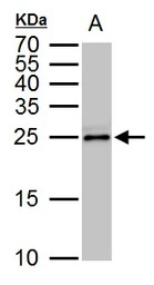 TPPP antibody [N1C3]