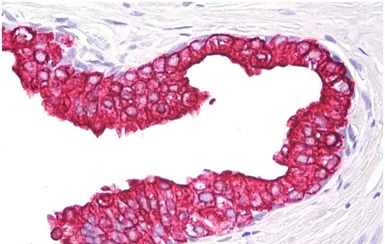 Cytokeratin 5 + 18 antibody [C