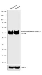 beta Arrestin 1 (phospho Ser41